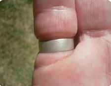 Stuck Wedding Ring